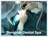 implant dentistry in thailand