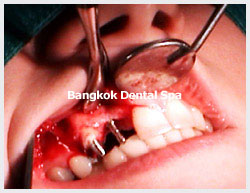 dental bangkok