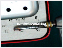 dental thailand