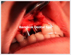 dentalbangkok