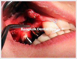 bangkokdental