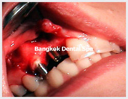 thailanddental