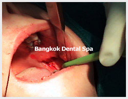 bangkokdental