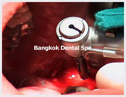 bangkokdentalthailand