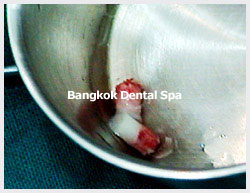 thailand dental