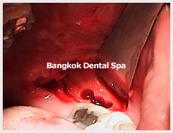 dental thailand