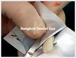 bangkok dental