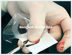 dentalimplantsthailand