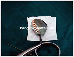 dentalimplantbangkok